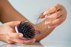 Hairloss treatments for Alopecia in Tampa Florida